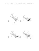 METHOD OF USING A SURGICAL TISSUE RETRACTOR diagram and image