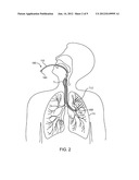 METHODS AND SYSTEMS FOR ENDOBRONCHIAL DIAGNOSTICS diagram and image