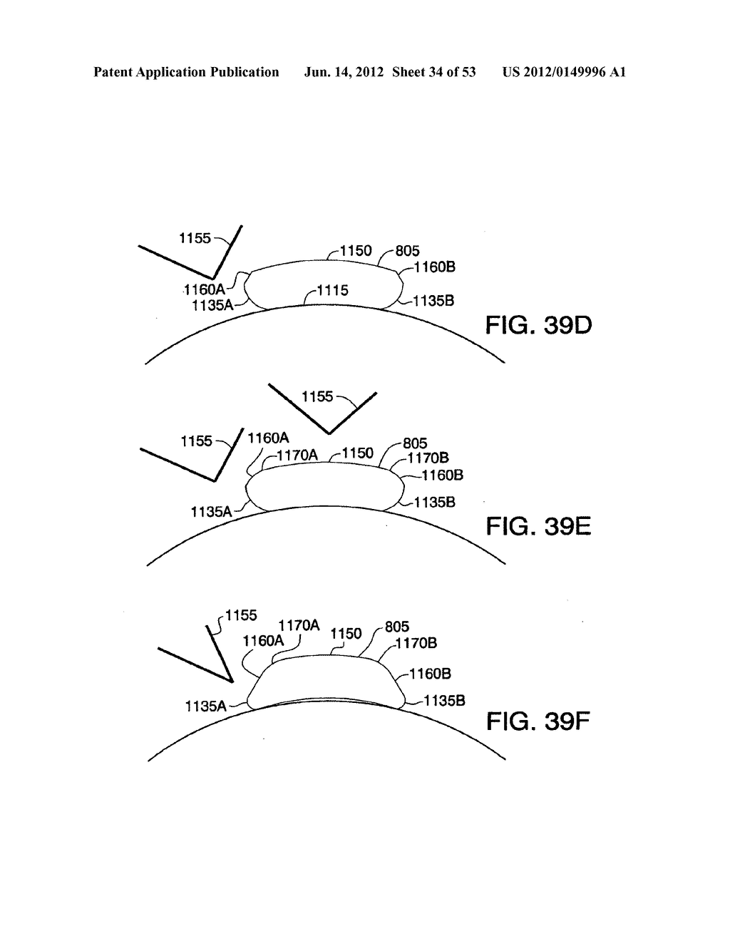 Method and apparatus for providing derived glucose information utilizing     physiological and/or contextual parameters - diagram, schematic, and image 35