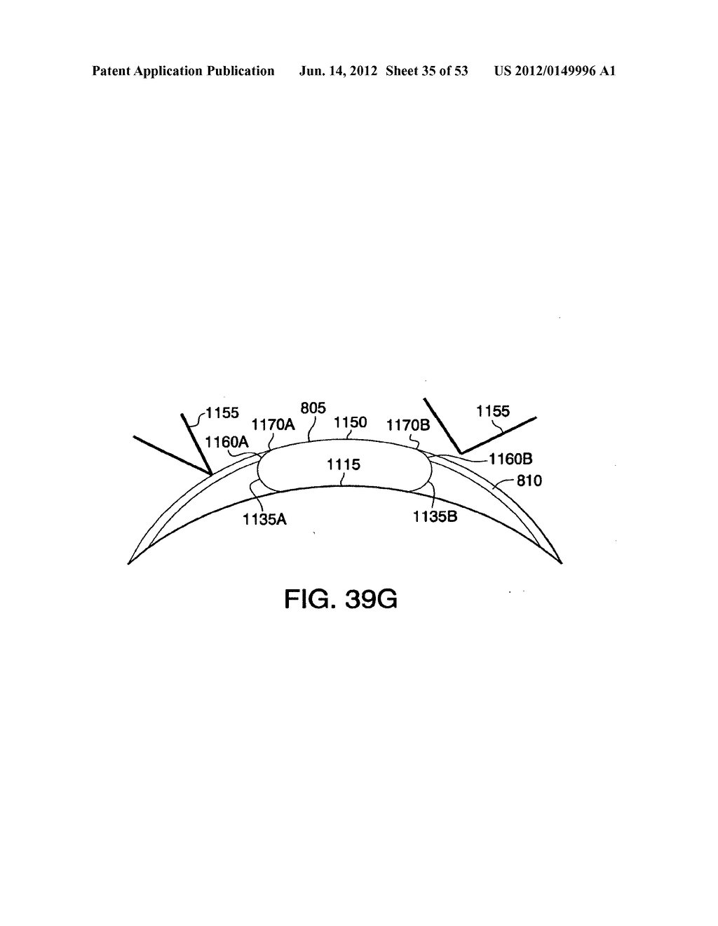 Method and apparatus for providing derived glucose information utilizing     physiological and/or contextual parameters - diagram, schematic, and image 36