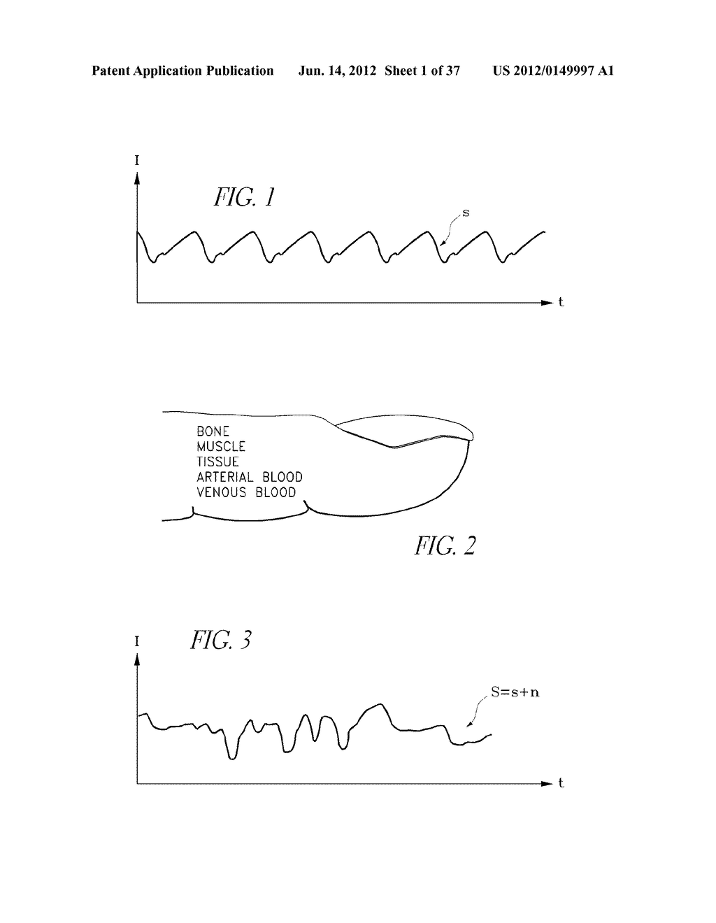 SIGNAL PROCESSING APPARATUS - diagram, schematic, and image 02