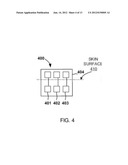 Analyte Sensors with a Sensing Surface Having Small Sensing Spots diagram and image