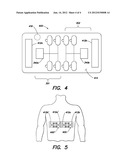 ELECTRODE WITH REDUNDANT IMPEDANCE REDUCTION diagram and image