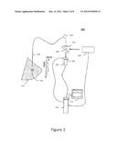 System and Method of Chemical Imaging Using Puled Laser Excitation and     Time-Gated Detection to Determine Tissue Margins During Surgery diagram and image