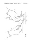 ANTIMICROBIAL ULTRASOUND TRANSMISSION GEL diagram and image