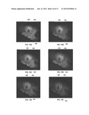 TISSUE CONTRAST IMAGING SYSTEMS diagram and image