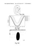 VASCULAR ANALYSIS METHODS AND APPARATUS diagram and image