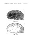 VASCULAR ANALYSIS METHODS AND APPARATUS diagram and image