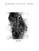 VASCULAR ANALYSIS METHODS AND APPARATUS diagram and image