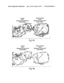 VASCULAR ANALYSIS METHODS AND APPARATUS diagram and image