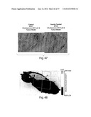 VASCULAR ANALYSIS METHODS AND APPARATUS diagram and image