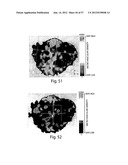 VASCULAR ANALYSIS METHODS AND APPARATUS diagram and image