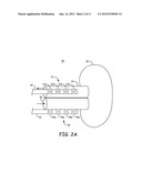 IMPEDANCE MEASUREMENT TO MONITOR ORGAN PERFUSION OR HEMODYNAMIC STATUS diagram and image