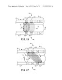 IMPEDANCE MEASUREMENT TO MONITOR ORGAN PERFUSION OR HEMODYNAMIC STATUS diagram and image