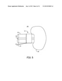 IMPEDANCE MEASUREMENT TO MONITOR ORGAN PERFUSION OR HEMODYNAMIC STATUS diagram and image