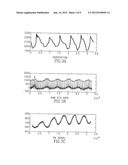 APPARATUS AND METHOD FOR ESTIMATING STROKE VOLUME OF THE HEART USING     BIO-IMPEDANCE TECHNIQUES diagram and image