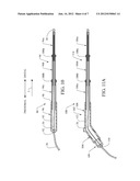 HANDHELD EMG STIMULATOR DEVICE WITH ADJUSTABLE SHAFT LENGTH diagram and image