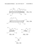 HANDHELD EMG STIMULATOR DEVICE WITH ADJUSTABLE SHAFT LENGTH diagram and image