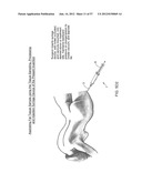 TISSUE SAMPLING, COLLECTION, AND PROCESSING SYSTEM diagram and image