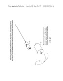 TISSUE SAMPLING, COLLECTION, AND PROCESSING SYSTEM diagram and image