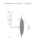 MEDICAL DRESSING AND NEGATIVE PRESSURE WOUND THERAPY APPARATUS USING THE     SAME diagram and image