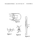 SUPPORT UNIT FOR PHYSICALLY HANDICAPPED PATIENTS diagram and image