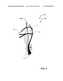 SPINE-ALIGN GARMENT SYSTEMS diagram and image