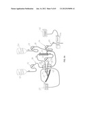 System and Method for Delivery of Regional Citrate Anticoagulation to     Extracorporeal Blood Circuits diagram and image