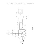 System and Method for Delivery of Regional Citrate Anticoagulation to     Extracorporeal Blood Circuits diagram and image