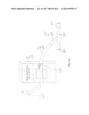 System and Method for Delivery of Regional Citrate Anticoagulation to     Extracorporeal Blood Circuits diagram and image