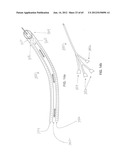 System and Method for Delivery of Regional Citrate Anticoagulation to     Extracorporeal Blood Circuits diagram and image