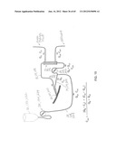 System and Method for Delivery of Regional Citrate Anticoagulation to     Extracorporeal Blood Circuits diagram and image