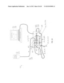 System and Method for Delivery of Regional Citrate Anticoagulation to     Extracorporeal Blood Circuits diagram and image