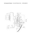 System and Method for Delivery of Regional Citrate Anticoagulation to     Extracorporeal Blood Circuits diagram and image