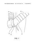 GUIDED PERCUTANEOUS BYPASS diagram and image