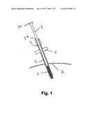 MEDICAL INSTRUMENT FOR MICRO-INVASIVE APPLICATIONS diagram and image