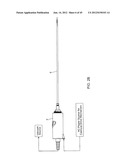 TISSUE ASPIRATION INSTRUMENT EMPLOYING TWIN IRRIGATING-TYPE     ELECTRO-CAUTERIZING CANNULA ASSEMBLY diagram and image