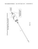 TISSUE ASPIRATION INSTRUMENT EMPLOYING TWIN IRRIGATING-TYPE     ELECTRO-CAUTERIZING CANNULA ASSEMBLY diagram and image