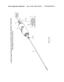 TISSUE ASPIRATION INSTRUMENT EMPLOYING TWIN IRRIGATING-TYPE     ELECTRO-CAUTERIZING CANNULA ASSEMBLY diagram and image