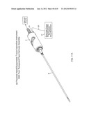 TISSUE ASPIRATION INSTRUMENT EMPLOYING TWIN IRRIGATING-TYPE     ELECTRO-CAUTERIZING CANNULA ASSEMBLY diagram and image