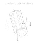 TISSUE ASPIRATION INSTRUMENT EMPLOYING TWIN IRRIGATING-TYPE     ELECTRO-CAUTERIZING CANNULA ASSEMBLY diagram and image