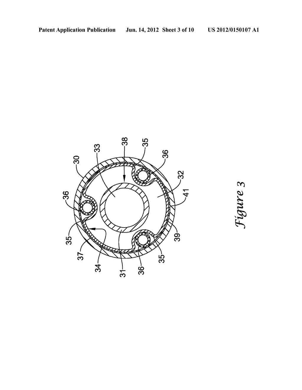 BALLOON CATHETER SHAFTS AND METHODS OF MANUFACTURING - diagram, schematic, and image 04