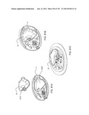 ADHESIVE AND PERIPHERAL SYSTEMS AND METHODS FOR MEDICAL DEVICES diagram and image