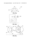 INFUSION SET diagram and image