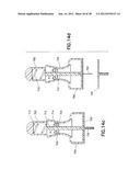 INFUSION SET diagram and image