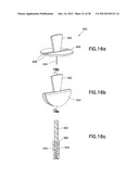 INFUSION SET diagram and image