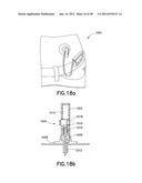 INFUSION SET diagram and image