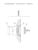 INFUSION SET diagram and image