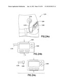 INFUSION SET diagram and image