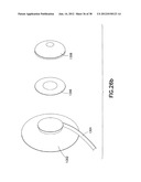 INFUSION SET diagram and image